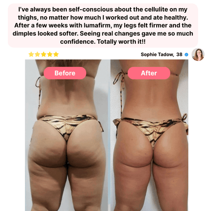 ThisLumaFirm™- cellulite massager